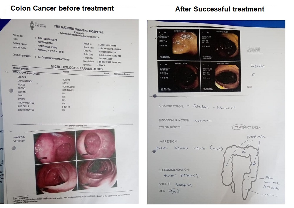 maggie cancer testimony maggie cancer testimony
